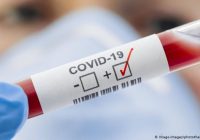 Се намалува бројот на новозаболени од Ковид-19 во државата